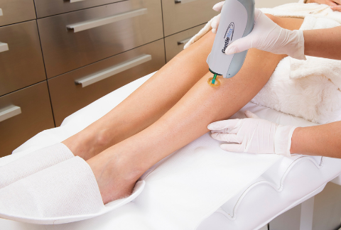 Zdjęcie - GentleMax - pain-free laser depilation (epilation) treatment