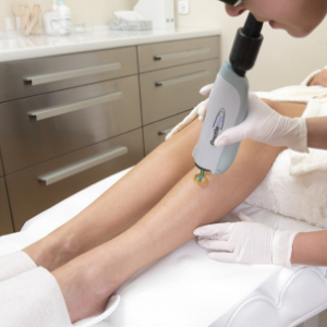 PAIN-FREE LASER HAIR REMOVAL (EPILATION) (GENTLEMAX)