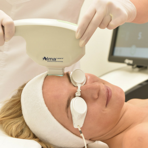 LASER REMOVAL OF ERYTHEMAS AND THE TREATMENT OF ACNE