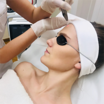 LASER PEELING (FOTONA DYNAMIS SP RESURFACING)